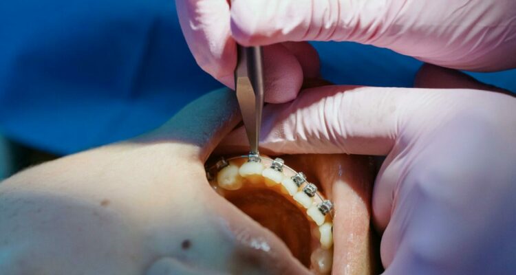 Ortodonzia | Servizi | Studio Dentistico Stramesi | Milano Ortodonzia | Servizi | Studio Dentistico Stramesi | Milano