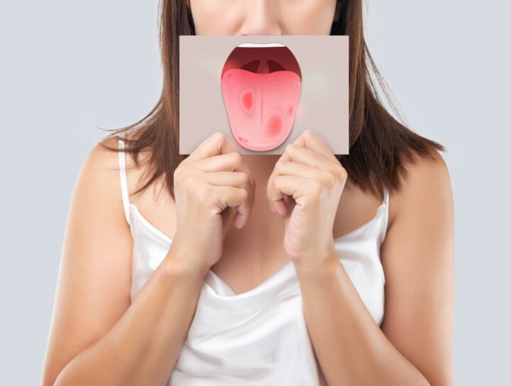 Alitosi: cause e rimedi | Blog | Studio Dentistico Stramesi Milano