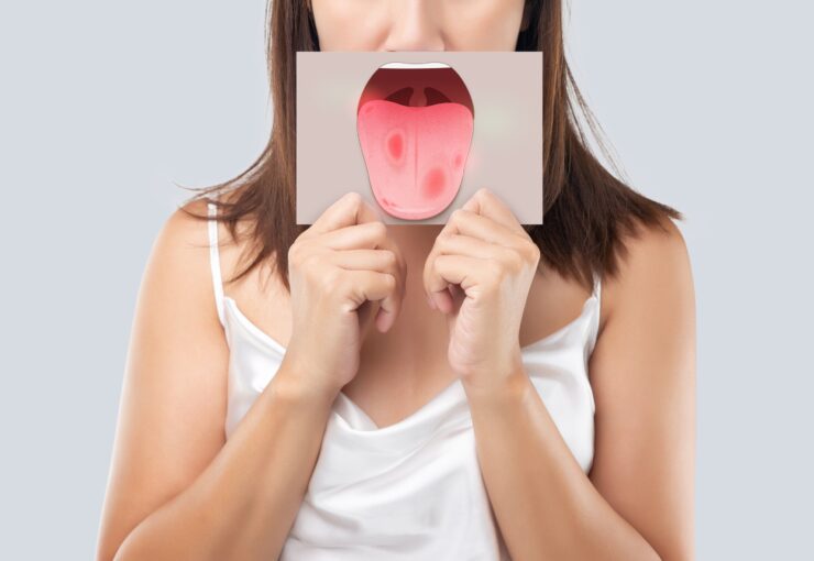 Alitosi: cause e rimedi | Blog | Studio Dentistico Stramesi Milano