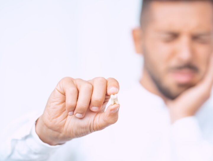 Denti del giudizio | Blog | Studio Dentistico Stramesi Milano