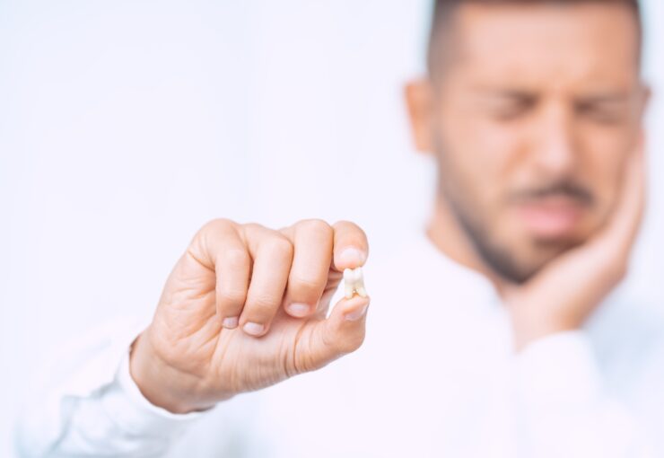 Denti del giudizio | Blog | Studio Dentistico Stramesi Milano