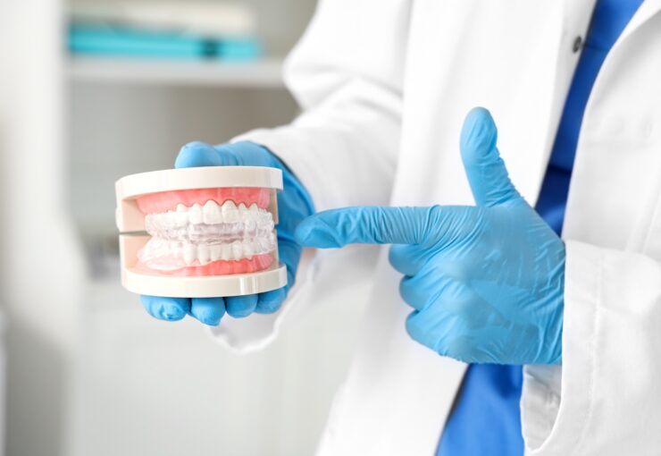 Occlusione dentale | Blog | Studio Dentistico Stramesi Milano