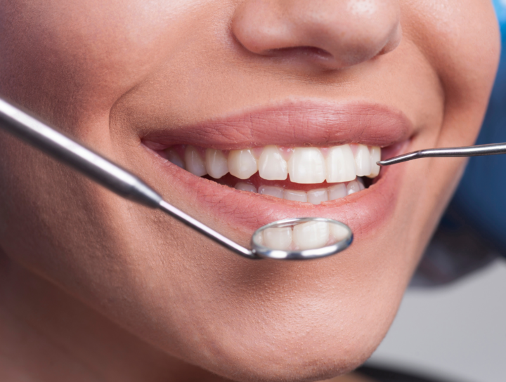 Primo piano di un controllo dentale con specchietto e sonda sui denti di una paziente
