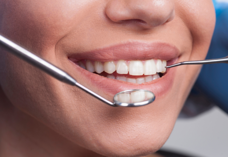 Primo piano di un controllo dentale con specchietto e sonda sui denti di una paziente