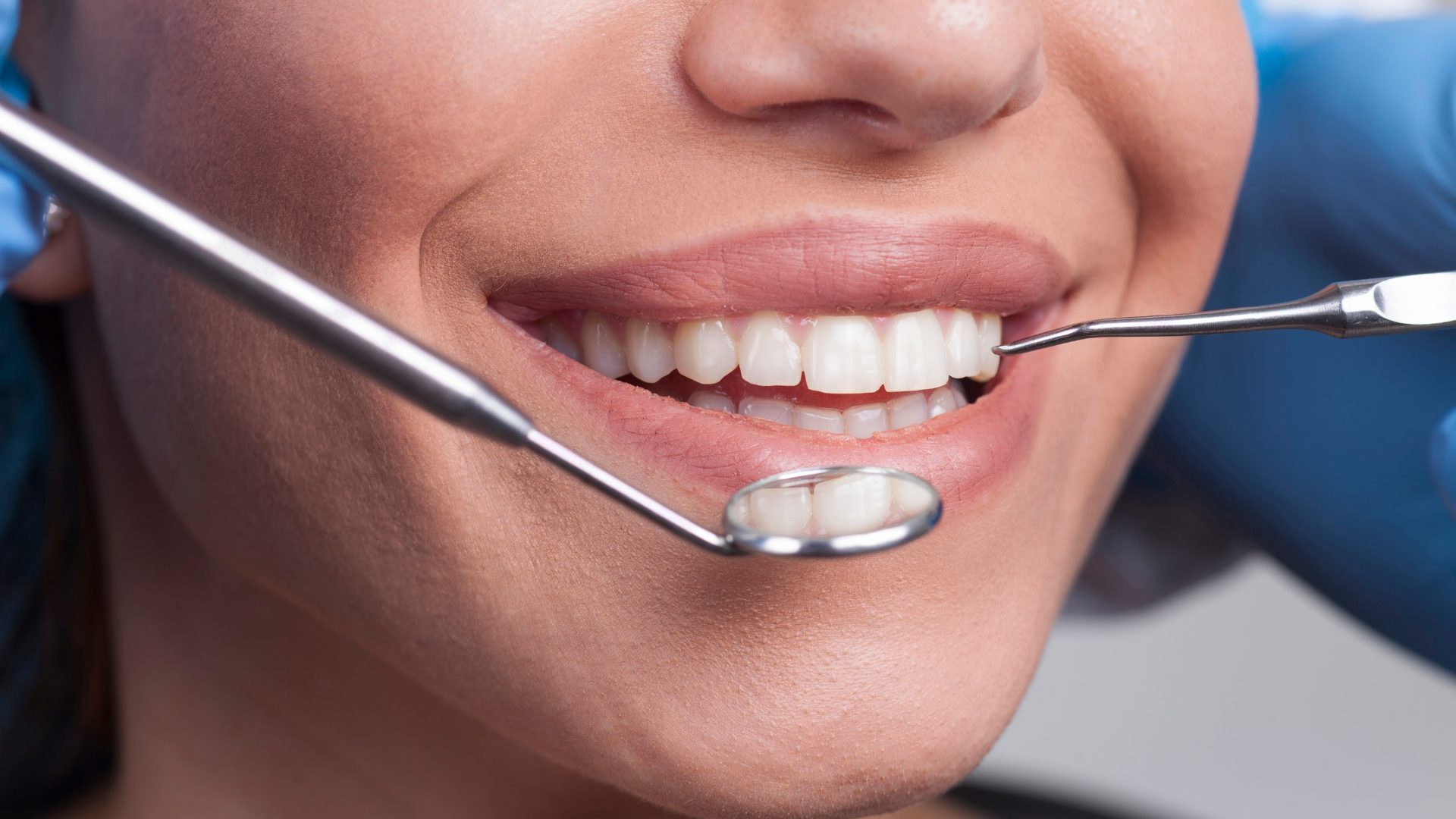 Primo piano di un controllo dentale con specchietto e sonda sui denti di una paziente