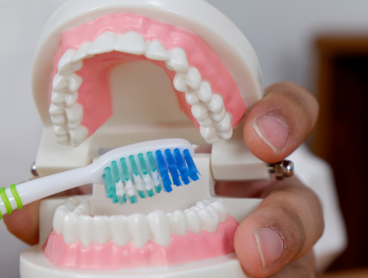 Corone, ponti e impianti: dimostrazione dello spazzolamento corretto su un modello dentale