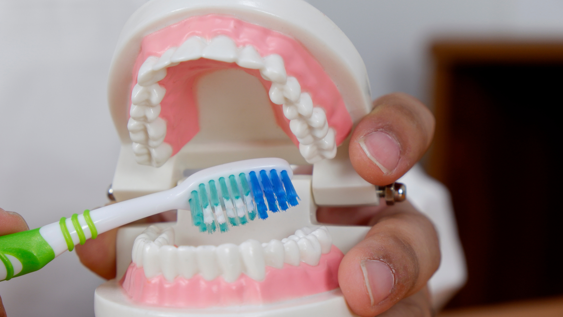 Corone, ponti e impianti: dimostrazione dello spazzolamento corretto su un modello dentale